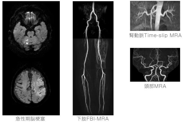 MRI検査2