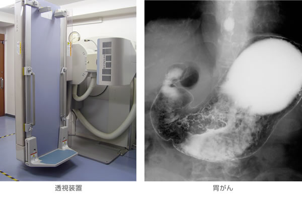 X線透視検査